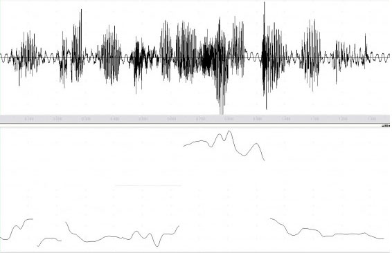 Intonation: Frage